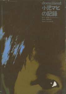 小児マヒの記録　脳性・脊椎マヒとのたたかいのサムネール